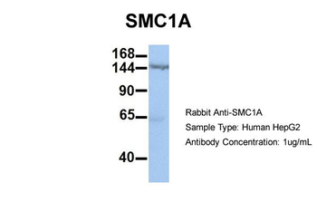 SMC1A Rabbit Polyclonal Antibody