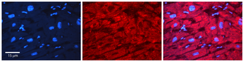 SMC1A Rabbit Polyclonal Antibody