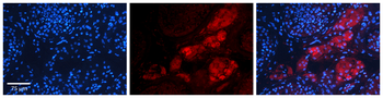 KAT5 Rabbit Polyclonal Antibody