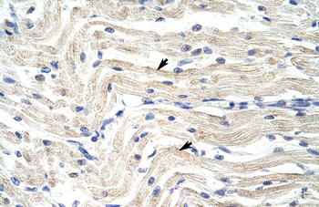 ELL Rabbit Polyclonal Antibody