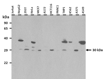 LBX1 Rabbit Polyclonal Antibody