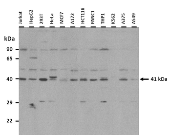 HOXA2 Rabbit Polyclonal Antibody