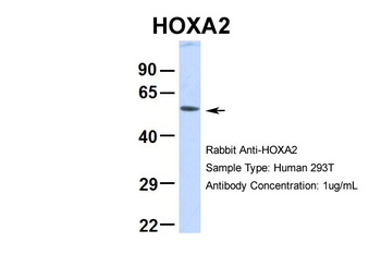 HOXA2 Rabbit Polyclonal Antibody
