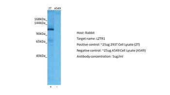 LZTR1 Rabbit Polyclonal Antibody