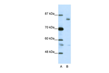 LZTR1 Rabbit Polyclonal Antibody