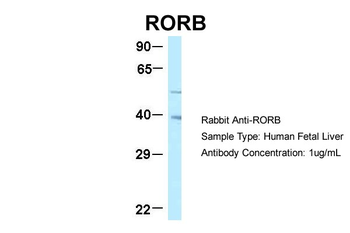 RORB Rabbit Polyclonal Antibody