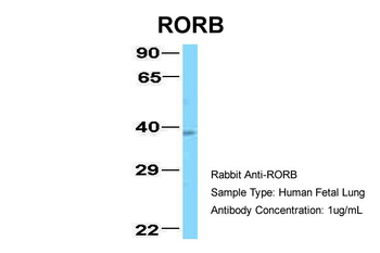 RORB Rabbit Polyclonal Antibody