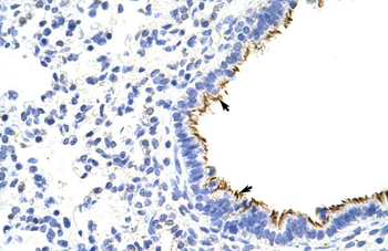 ZNF16 Rabbit Polyclonal Antibody