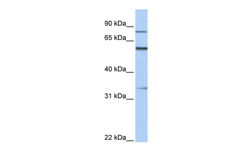 ZNF16 Rabbit Polyclonal Antibody