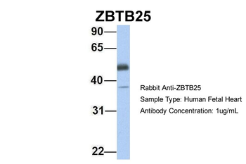 ZBTB25 Rabbit Polyclonal Antibody