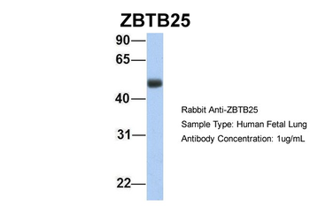 ZBTB25 Rabbit Polyclonal Antibody