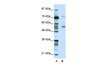 CORO1A Rabbit Polyclonal Antibody