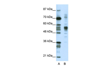 CORO1A Rabbit Polyclonal Antibody