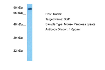 STAT1 Rabbit Polyclonal Antibody