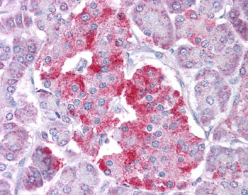 STAT1 Rabbit Polyclonal Antibody