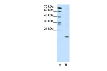 DUX5 Rabbit Polyclonal Antibody