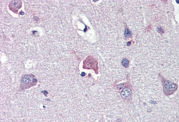 LDOC1 Rabbit Polyclonal Antibody