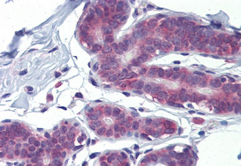 LDOC1 Rabbit Polyclonal Antibody