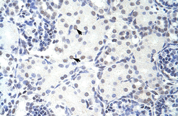 GMEB2 Rabbit Polyclonal Antibody