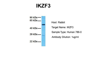 IKZF3 Rabbit Polyclonal Antibody