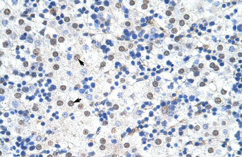 IKZF3 Rabbit Polyclonal Antibody