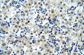 NFYC Rabbit Polyclonal Antibody