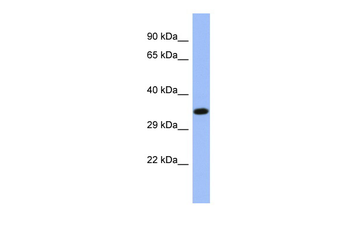 NR2E3 Rabbit Polyclonal Antibody