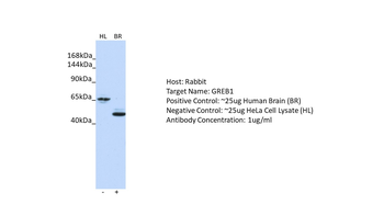 GREB1 Rabbit Polyclonal Antibody