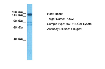 POGZ Rabbit Polyclonal Antibody