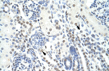 POGZ Rabbit Polyclonal Antibody