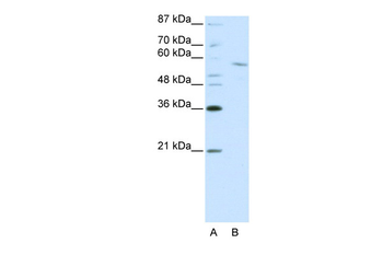 RCOR1 Rabbit Polyclonal Antibody