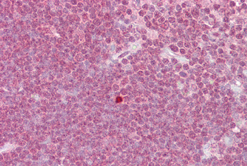 ZBTB7A Rabbit Polyclonal Antibody