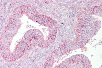 SUFU Rabbit Polyclonal Antibody