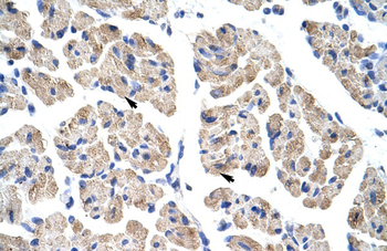 TLX2 Rabbit Polyclonal Antibody