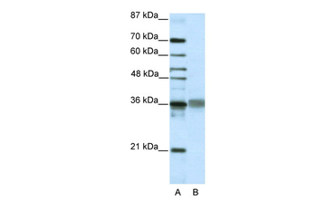 TLX2 Rabbit Polyclonal Antibody
