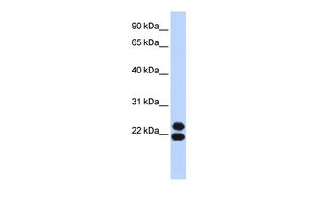PRRX2 Rabbit Polyclonal Antibody