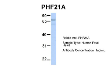 PHF21A Rabbit Polyclonal Antibody
