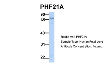 PHF21A Rabbit Polyclonal Antibody