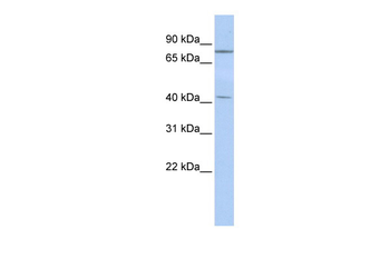 KLHL3 Rabbit Polyclonal Antibody