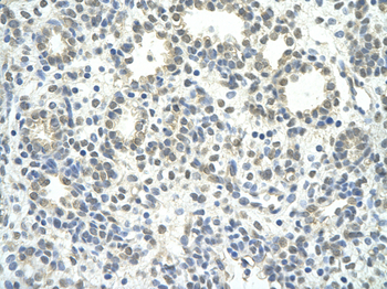 ZNF280D Rabbit Polyclonal Antibody