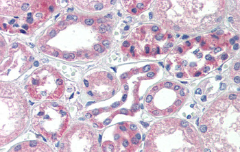 TRIM68 Rabbit Polyclonal Antibody