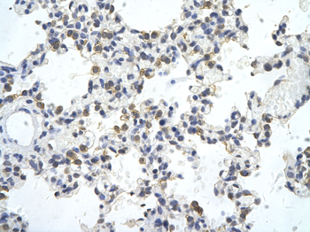 ZNF444 Rabbit Polyclonal Antibody