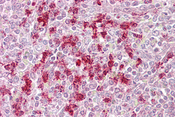 ZKSCAN4 Rabbit Polyclonal Antibody