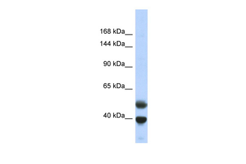 PRDM7 Rabbit Polyclonal Antibody