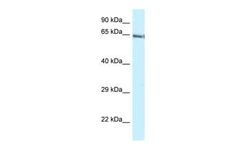 Gatad2b Rabbit Polyclonal Antibody