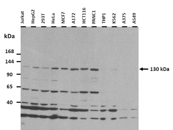 ZNF687 Rabbit Polyclonal Antibody