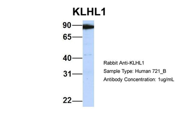 KLHL1 Rabbit Polyclonal Antibody