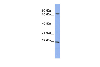 ZNF530 Rabbit Polyclonal Antibody