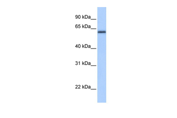 ZBTB26 Rabbit Polyclonal Antibody