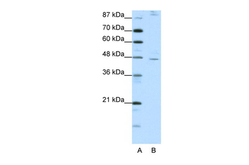 NR2F2 Rabbit Polyclonal Antibody